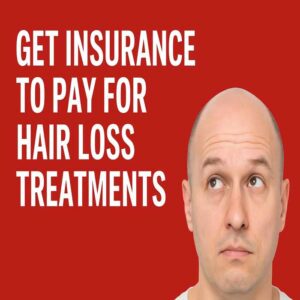 How to Get Insurance to Pay for Hair Loss Treatments 